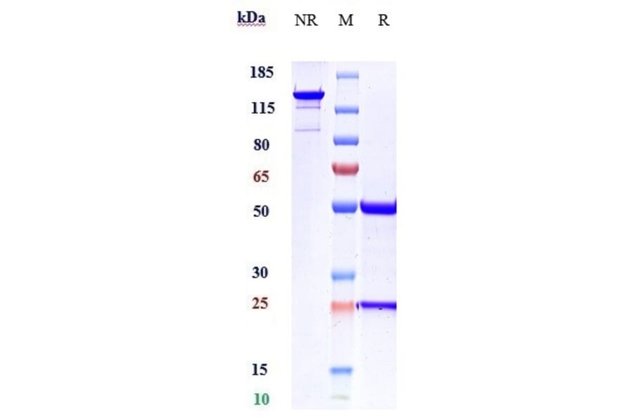 SDS-PAGE - Anti-Activin Receptor Type IIB/ACVR2B Antibody [Research Grade Biosimilar] - Low endotoxin, Azide free (A323877) - Antibodies.com
