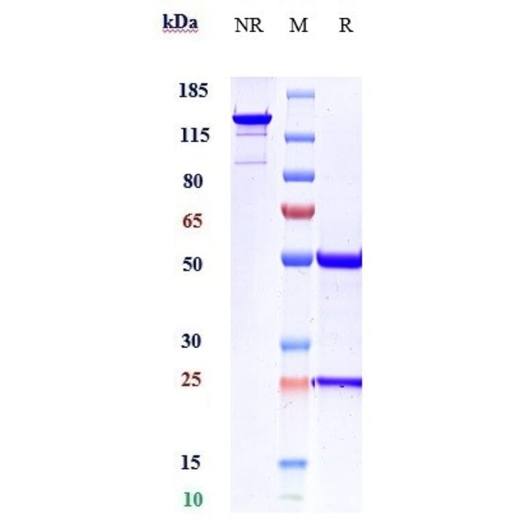 SDS-PAGE - Anti-Activin Receptor Type IIB/ACVR2B Antibody [Research Grade Biosimilar] - Low endotoxin, Azide free (A323877) - Antibodies.com