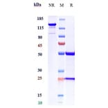 SDS-PAGE - Anti-Activin Receptor Type IIB/ACVR2B Antibody [Research Grade Biosimilar] - Low endotoxin, Azide free (A323877) - Antibodies.com