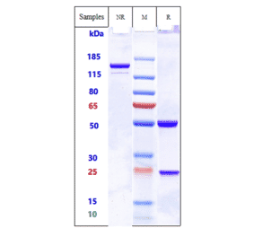 SDS-PAGE - Anti-ADAM9 Antibody [IMGC936] - Low endotoxin, Azide free (A323878) - Antibodies.com