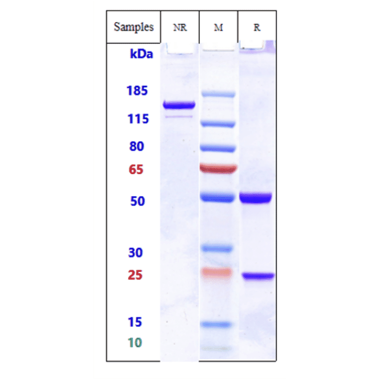 SDS-PAGE - Anti-ADAM9 Antibody [IMGC936] - Low endotoxin, Azide free (A323878) - Antibodies.com