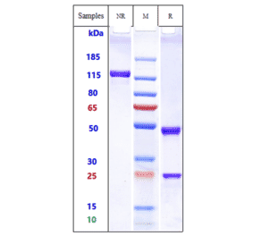 SDS-PAGE - Anti-Albumin Antibody [Research Grade Biosimilar] - Low endotoxin, Azide free (A323880) - Antibodies.com