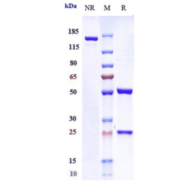 SDS-PAGE - Anti-Albumin Antibody [Research Grade Biosimilar] - Low endotoxin, Azide free (A323881) - Antibodies.com
