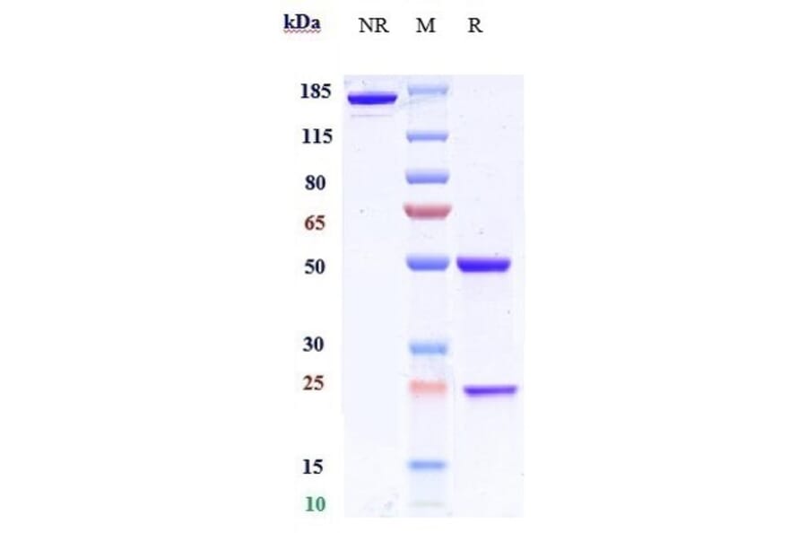 SDS-PAGE - Anti-BACE1 Antibody [Research Grade Biosimilar] - Low endotoxin, Azide free (A323890) - Antibodies.com