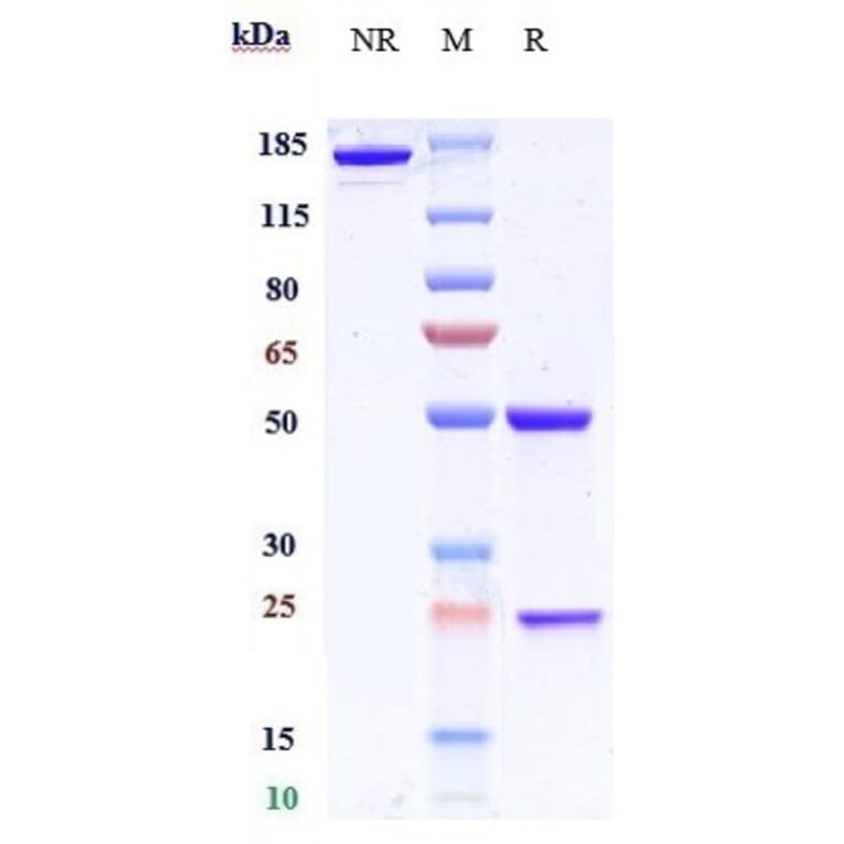 SDS-PAGE - Anti-BACE1 Antibody [Research Grade Biosimilar] - Low endotoxin, Azide free (A323890) - Antibodies.com