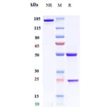 SDS-PAGE - Anti-BACE1 Antibody [Research Grade Biosimilar] - Low endotoxin, Azide free (A323890) - Antibodies.com