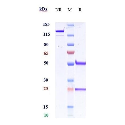 SDS-PAGE - Anti-beta Amyloid Antibody [Research Grade Biosimilar] - Low endotoxin, Azide free (A323892) - Antibodies.com