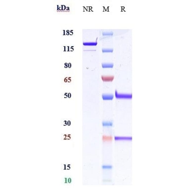 SDS-PAGE - Anti-beta Amyloid Antibody [Research Grade Biosimilar] - Low endotoxin, Azide free (A323892) - Antibodies.com