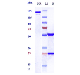SDS-PAGE - Anti-beta Amyloid Antibody [Research Grade Biosimilar] - Low endotoxin, Azide free (A323893) - Antibodies.com