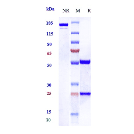 SDS-PAGE - Anti-beta Amyloid Antibody [Research Grade Biosimilar] - Low endotoxin, Azide free (A323893) - Antibodies.com