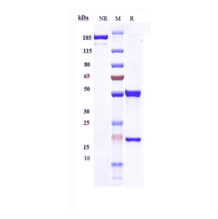 SDS-PAGE - Anti-beta Amyloid Antibody [Research Grade Biosimilar] - Low endotoxin, Azide free (A323894) - Antibodies.com