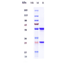 SDS-PAGE - Anti-beta Amyloid Antibody [Research Grade Biosimilar] - Low endotoxin, Azide free (A323895) - Antibodies.com