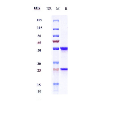 SDS-PAGE - Anti-beta Amyloid Antibody [Research Grade Biosimilar] - Low endotoxin, Azide free (A323895) - Antibodies.com