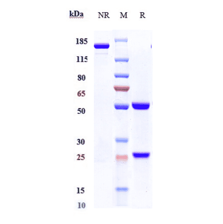 SDS-PAGE - Anti-beta Amyloid Antibody [Research Grade Biosimilar] - Low endotoxin, Azide free (A323896) - Antibodies.com