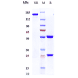 SDS-PAGE - Anti-beta Amyloid Antibody [Research Grade Biosimilar] - Low endotoxin, Azide free (A323896) - Antibodies.com