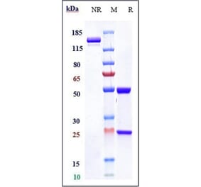 SDS-PAGE - Anti-beta Amyloid Antibody [Research Grade Biosimilar] - Low endotoxin, Azide free (A323897) - Antibodies.com