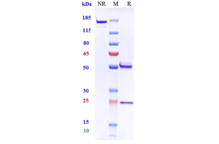 SDS-PAGE - Anti-beta Amyloid Antibody [Research Grade Biosimilar] - Low endotoxin, Azide free (A323898) - Antibodies.com