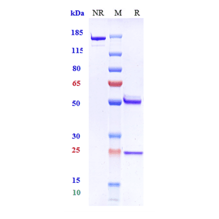 SDS-PAGE - Anti-beta Amyloid Antibody [Research Grade Biosimilar] - Low endotoxin, Azide free (A323898) - Antibodies.com