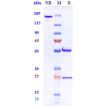 SDS-PAGE - Anti-beta Amyloid Antibody [Research Grade Biosimilar] - Low endotoxin, Azide free (A323898) - Antibodies.com