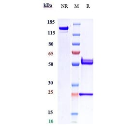 SDS-PAGE - Anti-beta Amyloid Antibody [DLX212] - Low endotoxin, Azide free (A323899) - Antibodies.com