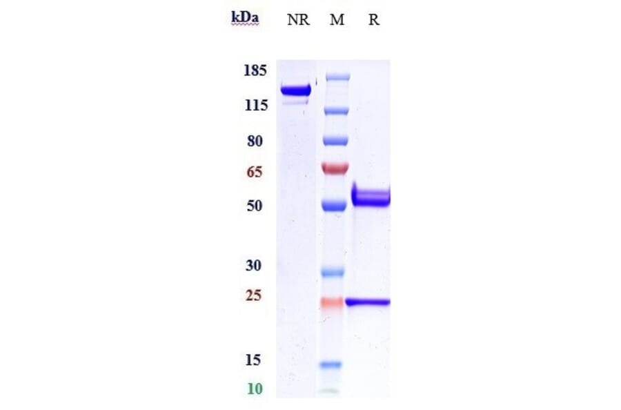 SDS-PAGE - Anti-beta Amyloid Antibody [DLX212] - Low endotoxin, Azide free (A323899) - Antibodies.com