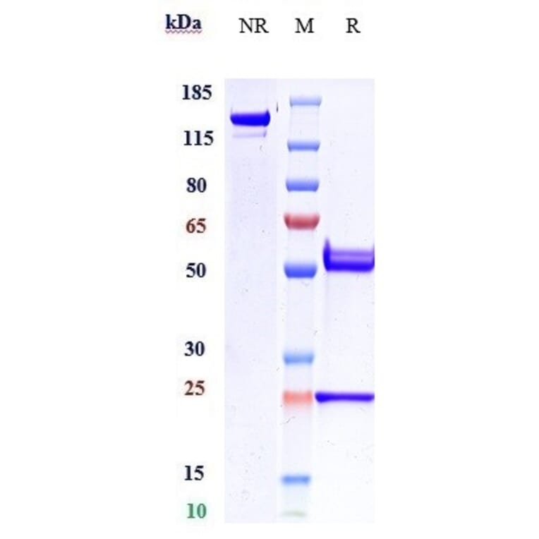 SDS-PAGE - Anti-beta Amyloid Antibody [DLX212] - Low endotoxin, Azide free (A323899) - Antibodies.com