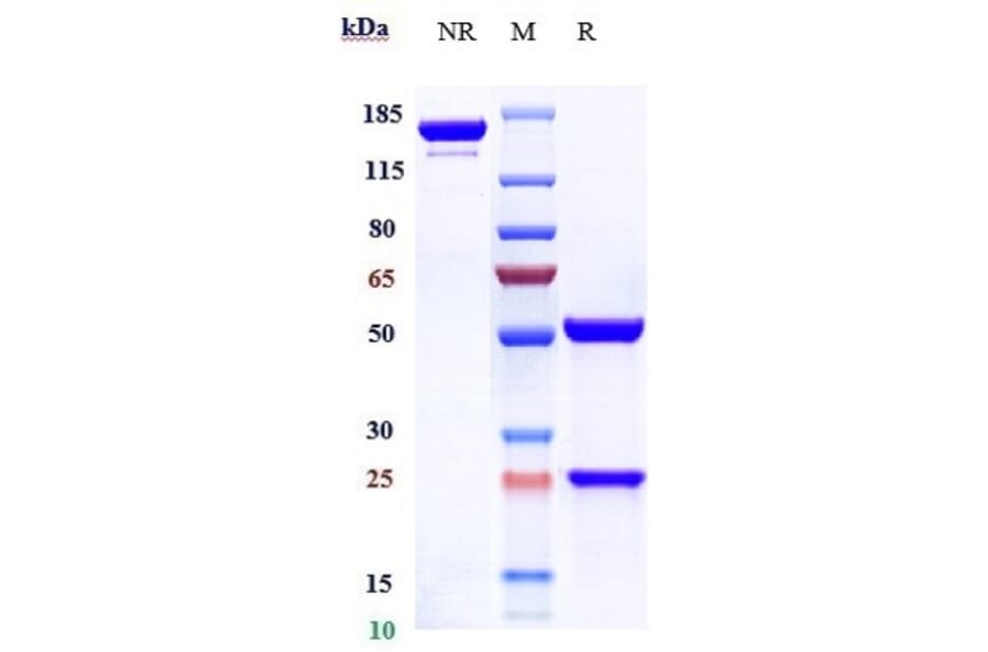 SDS-PAGE - Anti-beta Amyloid Antibody [CNTO 2125] - Low endotoxin, Azide free (A323900) - Antibodies.com