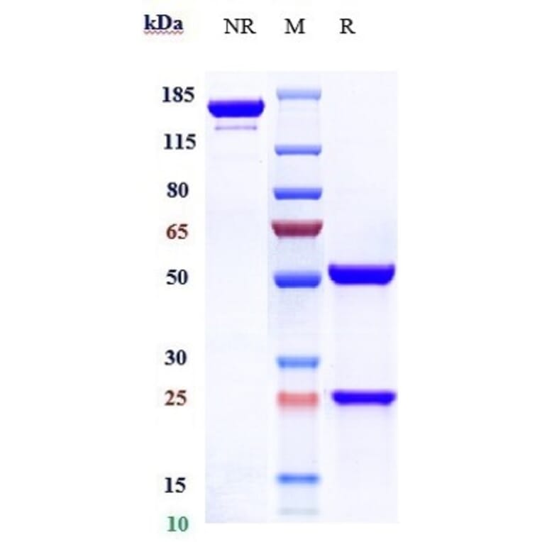 SDS-PAGE - Anti-beta Amyloid Antibody [CNTO 2125] - Low endotoxin, Azide free (A323900) - Antibodies.com