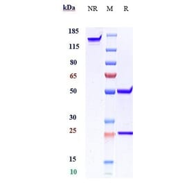 SDS-PAGE - Anti-beta Amyloid Antibody [GSK 933776] - Low endotoxin, Azide free (A323901) - Antibodies.com