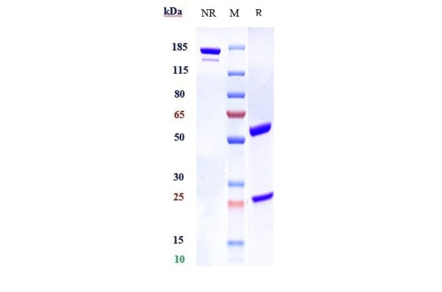 SDS-PAGE - Anti-Betatrophin Antibody [Research Grade Biosimilar] - Low endotoxin, Azide free (A323902) - Antibodies.com