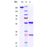 SDS-PAGE - Anti-BTN1A1 Antibody [ICT-01] - Low endotoxin, Azide free (A323905) - Antibodies.com