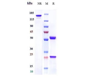SDS-PAGE - Anti-C1q Antibody [ANX005] - Low endotoxin, Azide free (A323907) - Antibodies.com