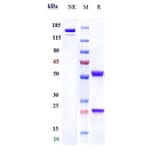 SDS-PAGE - Anti-C1q Antibody [ANX005] - Low endotoxin, Azide free (A323907) - Antibodies.com