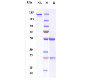 SDS-PAGE - Anti-C5a-R Antibody [Research Grade Biosimilar] - Low endotoxin, Azide free (A323911) - Antibodies.com