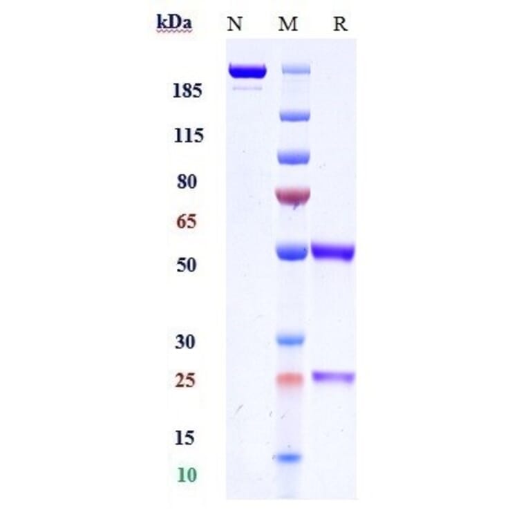 SDS-PAGE - Anti-Cannabinoid Receptor I Antibody [GFB-024] - Low endotoxin, Azide free (A323913) - Antibodies.com