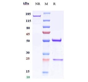 SDS-PAGE - Anti-CD151 Antibody [Research Grade Biosimilar] - Low endotoxin, Azide free (A323922) - Antibodies.com