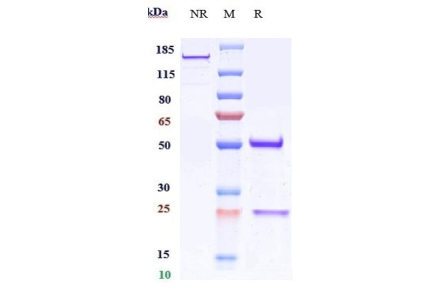 SDS-PAGE - Anti-CD151 Antibody [Research Grade Biosimilar] - Low endotoxin, Azide free (A323922) - Antibodies.com