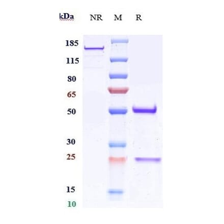 SDS-PAGE - Anti-CD151 Antibody [Research Grade Biosimilar] - Low endotoxin, Azide free (A323922) - Antibodies.com