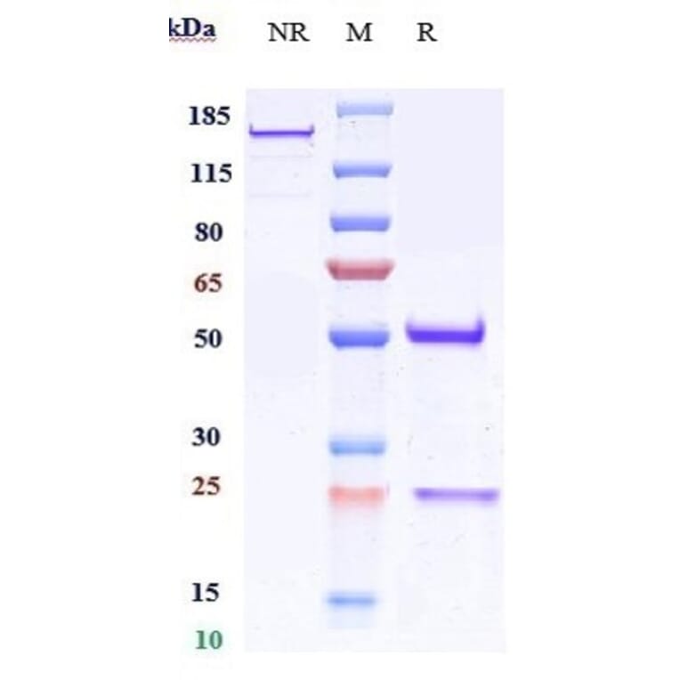 SDS-PAGE - Anti-CD151 Antibody [Research Grade Biosimilar] - Low endotoxin, Azide free (A323922) - Antibodies.com