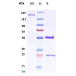 SDS-PAGE - Anti-CD151 Antibody [Research Grade Biosimilar] - Low endotoxin, Azide free (A323922) - Antibodies.com