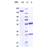 SDS-PAGE - Anti-CD167a/DDR1 Antibody [Research Grade Biosimilar] - Low endotoxin, Azide free (A323925) - Antibodies.com