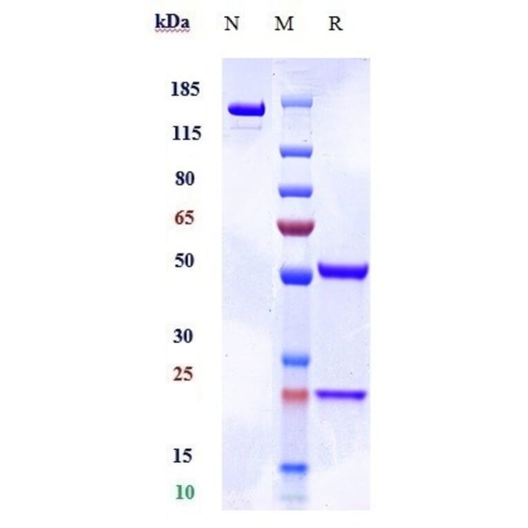 SDS-PAGE - Anti-CD172 gamma Antibody [KWAR23] - Low endotoxin, Azide free (A323926) - Antibodies.com