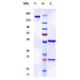 SDS-PAGE - Anti-CD172 gamma Antibody [KWAR23] - Low endotoxin, Azide free (A323926) - Antibodies.com