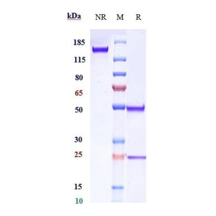SDS-PAGE - Anti-CD20 Antibody [TRU-015] - Low endotoxin, Azide free (A323930) - Antibodies.com