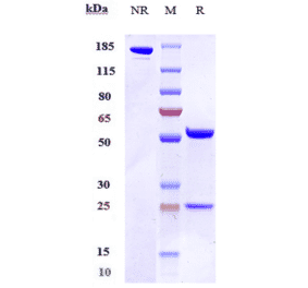 SDS-PAGE - Anti-CD200R Antibody [Research Grade Biosimilar] - Low endotoxin, Azide free (A323931) - Antibodies.com