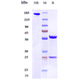 SDS-PAGE - Anti-CD200R Antibody [Research Grade Biosimilar] - Low endotoxin, Azide free (A323931) - Antibodies.com