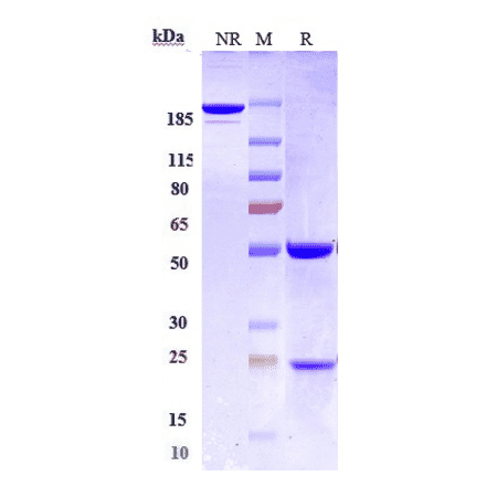 SDS-PAGE - Anti-CD22 Antibody [NCI m972] - Low endotoxin, Azide free (A323933) - Antibodies.com