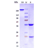 SDS-PAGE - Anti-CD22 Antibody [NCI m972] - Low endotoxin, Azide free (A323933) - Antibodies.com