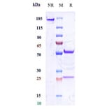 SDS-PAGE - Anti-CD34 Antibody [Research Grade Biosimilar] - Low endotoxin, Azide free (A323939) - Antibodies.com