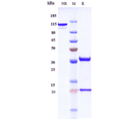 SDS-PAGE - Anti-CD36 Antibody [Research Grade Biosimilar] - Low endotoxin, Azide free (A323940) - Antibodies.com